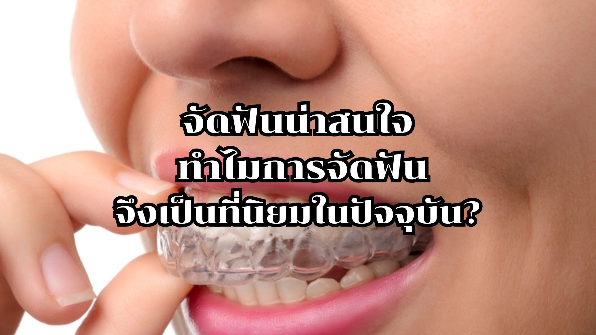 จัดฟันน่าสนใจ: ทำไมการจัดฟันจึงเป็นที่นิยมในปัจจุบัน?